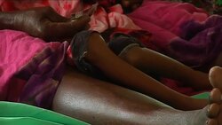 Doctors treat malnourished children in Kenya, Somalia ADDS Swiss Fed president Instructional Video