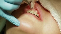 Healthcare Dental Cleaning Service at Clinic Stock Footage