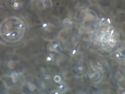 Human sperm, general shot, includes two-tailed sperm Stock Footage