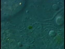 ECU microscopic view of bacteria and ciliate protozoans in freshwater farmyard pool sample Stock Footage