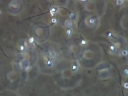 Human sperm Stock Footage