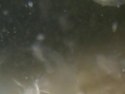 Daphnia with epibiotic growth. Epibiotic Ciliates growing on the surface of living Daphnia. Sample collected from Dolbryn pond and imaged using a 3mm Endoscope and Sony PMW-EX3 Full HD video camera. Horizontal field of view approximately 4mm. Stock Footage
