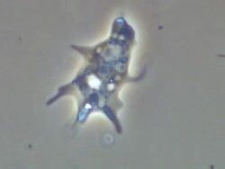 T/L microcinematography of Amoeba proteus viewed with phase contrast illumination. Stock Footage