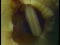 CU Grass Snake, Natrix natrix, inside egg, veined yolk, United Kingdom; SEQUENCE OF CLIPS, SPECIAL TERMS APPLY Stock Footage