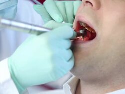 Young man in dentist office Stock Footage