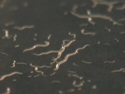 T/L Macro shot of Caenorhabditis elegans feeding on lawn of bacteria (Escherischia coli OP50) Stock Footage