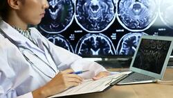Doctor's Examining Brain X-ray image result with Laptop Stock Footage