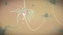 CTE: How Repeated Head Blows Affect the Brain News Clip