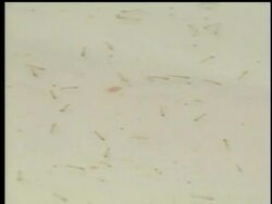 Scientists have created a new malaria-resistant mosquito.  The genetically-modified mosquito fed on malaria-infected mice and had twice the lifespan of non-resistant mosquitoes. News Clip