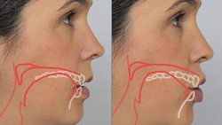 English Sounds - EW [ju] Diphthong - How to make the EW as in FEW Diphthong Instructional Video