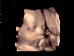 29-week-old foetus yawning, 4D ultrasound scan.. Stock Footage