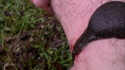 A large leech sucks blood from a man's arm. Stock Footage