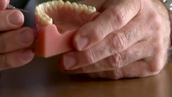 Study: Fluoride-Free Won't Stop Cavities News Clip