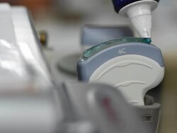 Ultrasound Stock Footage