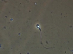 Single Human sperm swimming, best, Phase contrast Stock Footage