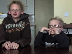 "Vampire" Brother Suffer From Rare Condition Stock Footage