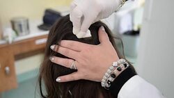 Cleaning wounds. Stock Footage