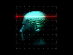 Brain Scan Display Stock Footage