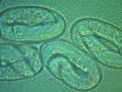 The Nematode Caenorhabditis elegans eggs  with embryo moving inside in bacterial lawn (Escherischia coli OP50). Stock Footage