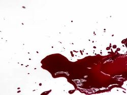 Blood droplets falling against white background, Slow motion Stock Footage