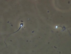 Single Human sperm swimming, best, Phase contrast Stock Footage