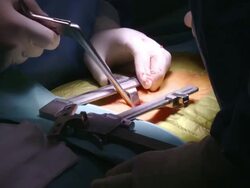  CU ZO Surgeons operating / Cagliari, Sardinia, Italy Stock Footage