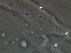 Human sperm, single sperm swimming, few others around Stock Footage