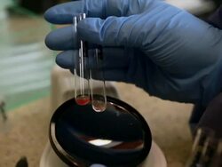 Lab Samples Stock Footage