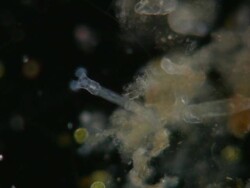 Philodina rotifer creating vortex current with beating cilia, for ingesting small microorganisms such as bacteria and algae.: Dark field illumination horizontal field of view 2mm. Stock Footage