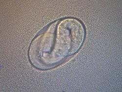 The Nematode Caenorhabditis elegans egg with embryo moving inside in bacterial lawn (Escherischia coli OP50). Stock Footage