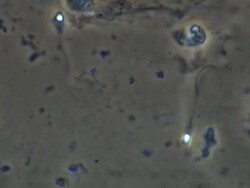 Human sperm, single sperm swimming Stock Footage