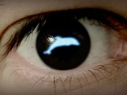 Dolphin shaped iris in eye. Stock Footage