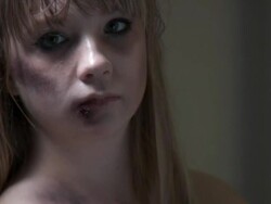 HD: Beaten Teen Begging For Help Stock Footage