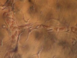 Capillaries of Toad tadpole tail. Olympus BH-2 microscope Olympus S-Plan 20x objective with 2.5x photoeyepiece. Differential Interference Contrast. Shutter speed 1/1000 second. Horizontal field of view 700 micrometres. Stock Footage