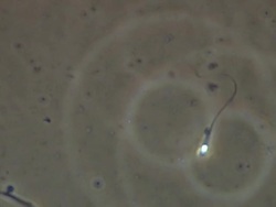 Single Human sperm swimming, Phase contrast Stock Footage