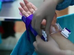 Angiography Stock Footage