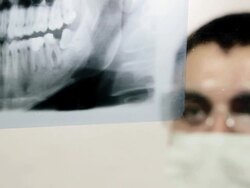 X-Ray scan Stock Footage