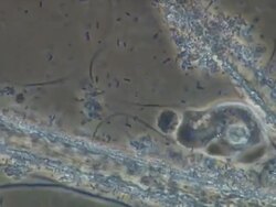 Amoeba from farmyard effluent - Phase Contrast T/L cinemicrography of farmyard effluent sample containing numerous types of bacteria, sewage fungus hyphae and amoeba Stock Footage