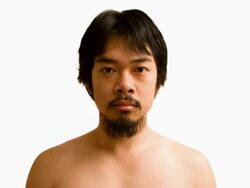 T/L Man's Changing Face Over 4 Months Stock Footage