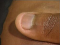 Pregnant women with virus get access to crucial anti-retroviral drugs News Clip