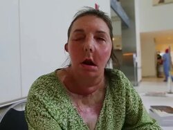 Face transplant recipient book signing Stock Footage