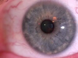 Eyeball Stock Footage