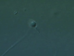 Single Human sperm swimming, big close up, Interference contrast Stock Footage