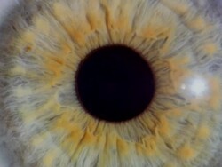 Contracting and dilating pupil Stock Footage