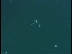 Microscopic view of Spirochaete bacteria Stock Footage