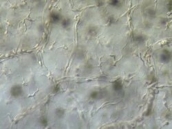 Blood cells moving through capillaries of tail of tadpole of Toad Bufo bufo Stock Footage