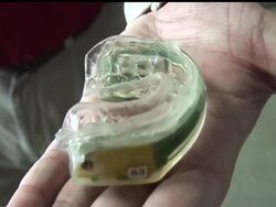 About two dozen Stanford players are wearing mouthpieces equipped with tiny sensors to measure the number and force of head impacts during games and practices. The sensors provide instant information to the sideline, where team trainers and doctors can monitor hits as they happen. News Clip