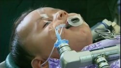 Hospital overwhelmed with hundreds needing eye treatment News Clip