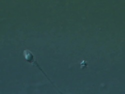 Single Human sperm swimming, big close up, Interference contrast Stock Footage