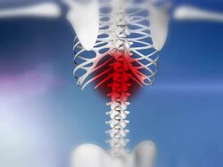 HD: Human Skeleton Indicates A Backache Stock Footage